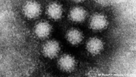 Norovirus transmission electron microscopy